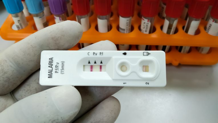 Traitement préventif contre le paludisme au centre de vaccination internationale de Lyon Parc Elsan. Image d'un test de dépistage du paludisme ou malaria.