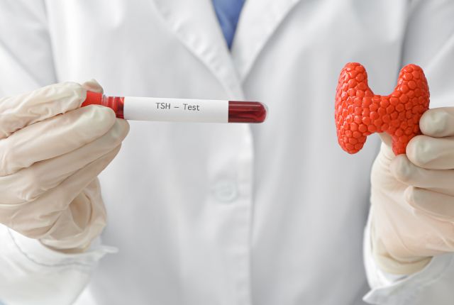 Un soignant tient d'un côté un flacon de prélèvement de sang pour un dosage de TSH et de l'autre une forme rouge représentant la thyroïde.