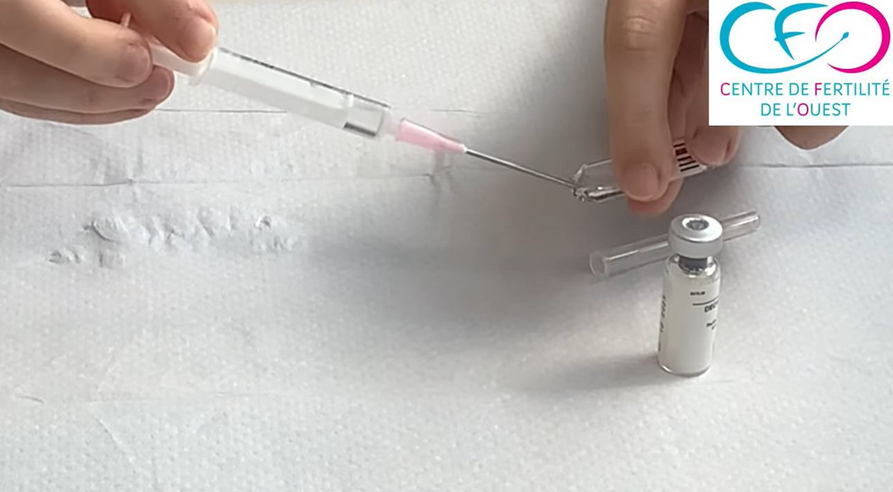 Tutoriel Décapeptyl