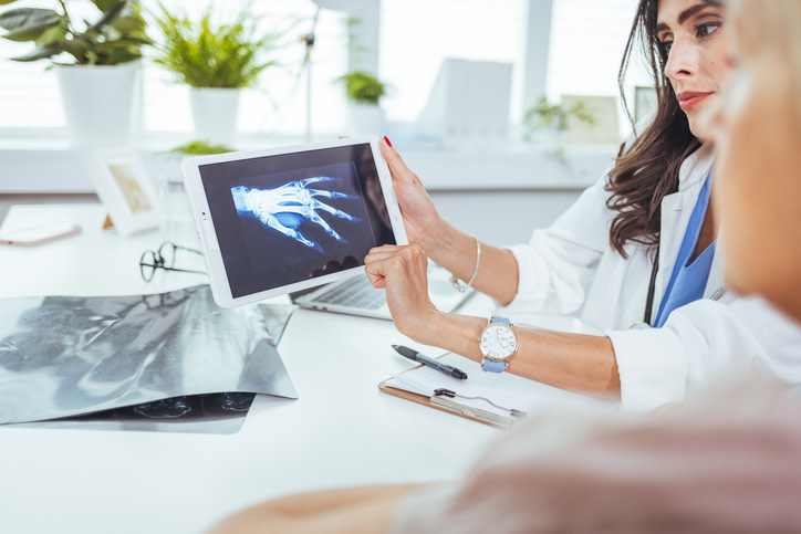 Illustration Fracture du scaphoïde