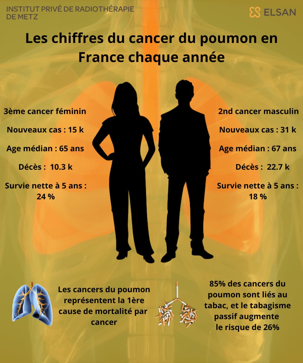 esperance vie cancer poumon France