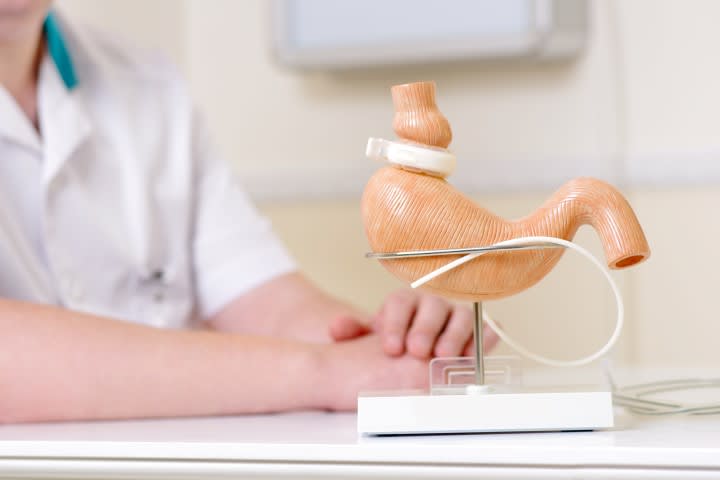 La chirurgie bariatrique
