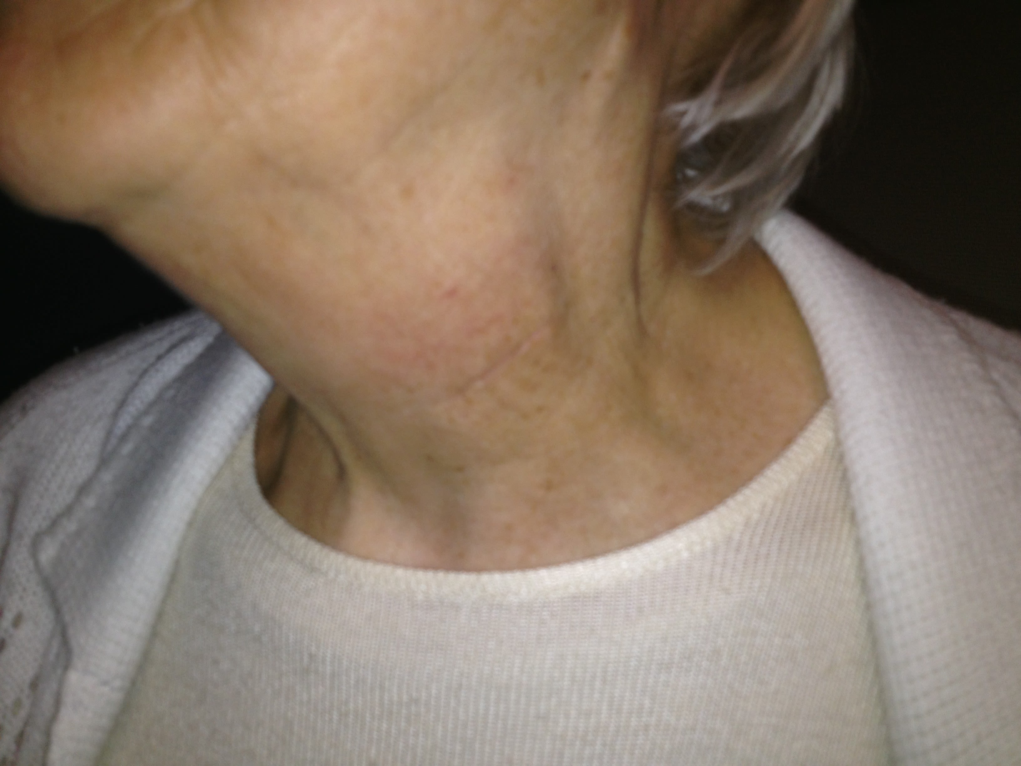 Les glandes parathyroïdes