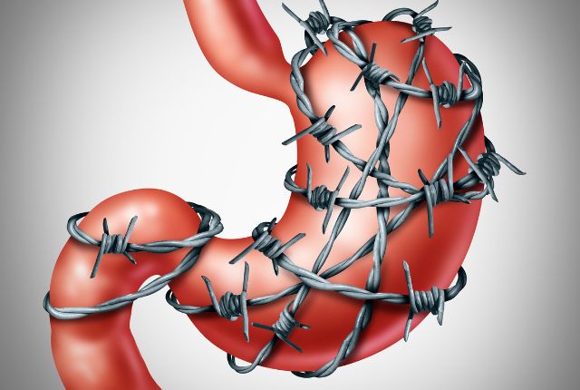 Les crampes d'estomac : définition, symptômes et traitements | Elsan