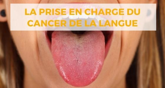 Cancer de la langue : Symptômes, diagnostic et traitement | Centre ...