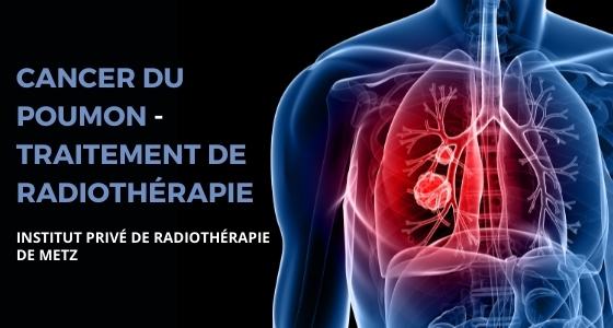 Cancer du poumon - Radiothérapie centre de cancérologie de Metz