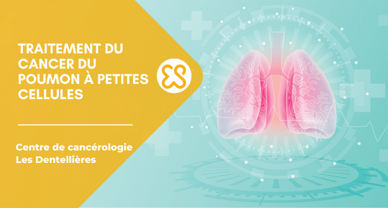 Cancer du poumon à petites cellules (CPPC) : traitements