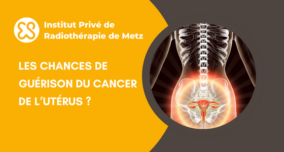 Cancer de l'utérus, stade et espérance de vie (Stade 4, stade 3)