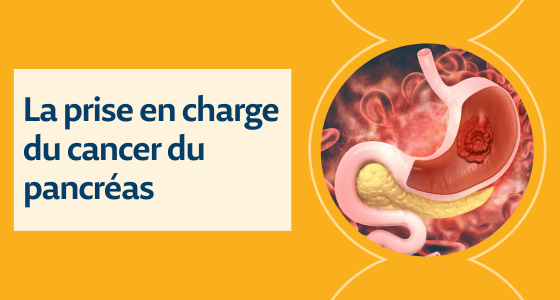 Cancer du pancréas : symptômes et durée de vie