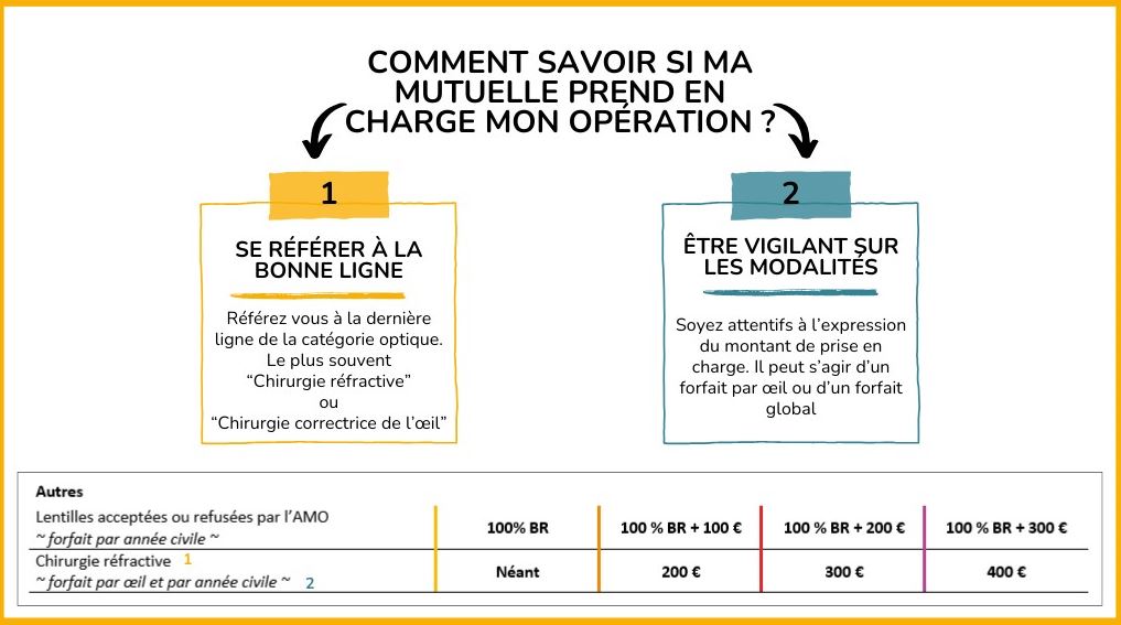 mutuelle operation des yeux au laser