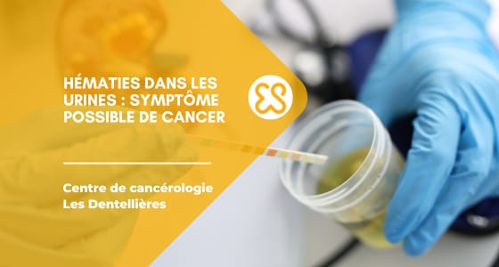 Hématies dans les urines - symptôme possible de cancer