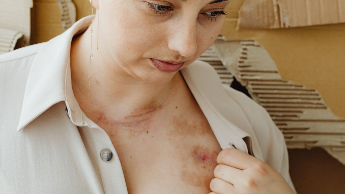 Living with mastocytosis poses daily challenges