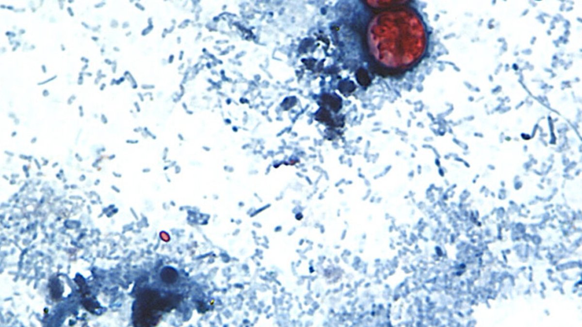 New Parasite Outbreak Sparks Diarrhea Cases Nationwide New Parasite Outbreak Sparks Diarrhea Cases Nationwide - cyclospora outbreak