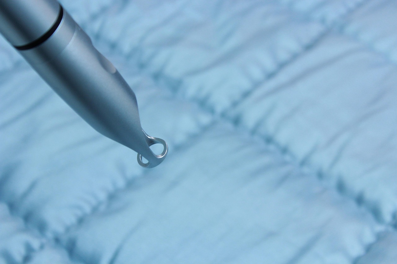 The Evolution of Smooth Skin The History of Laser Hair Removal