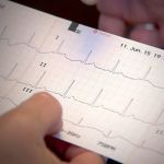 ECG Assessment: an Introduction for Healthcare Providers