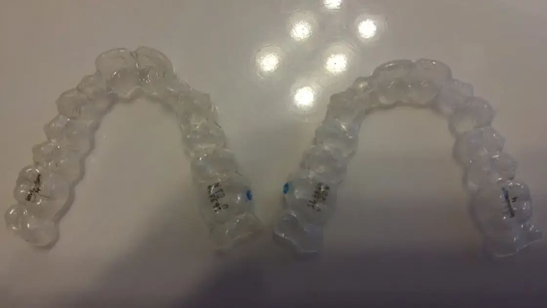 A clear orthodontic aligner tray of the kind used in adult Invisalign treatment — adult orthodontics in Utah Valley