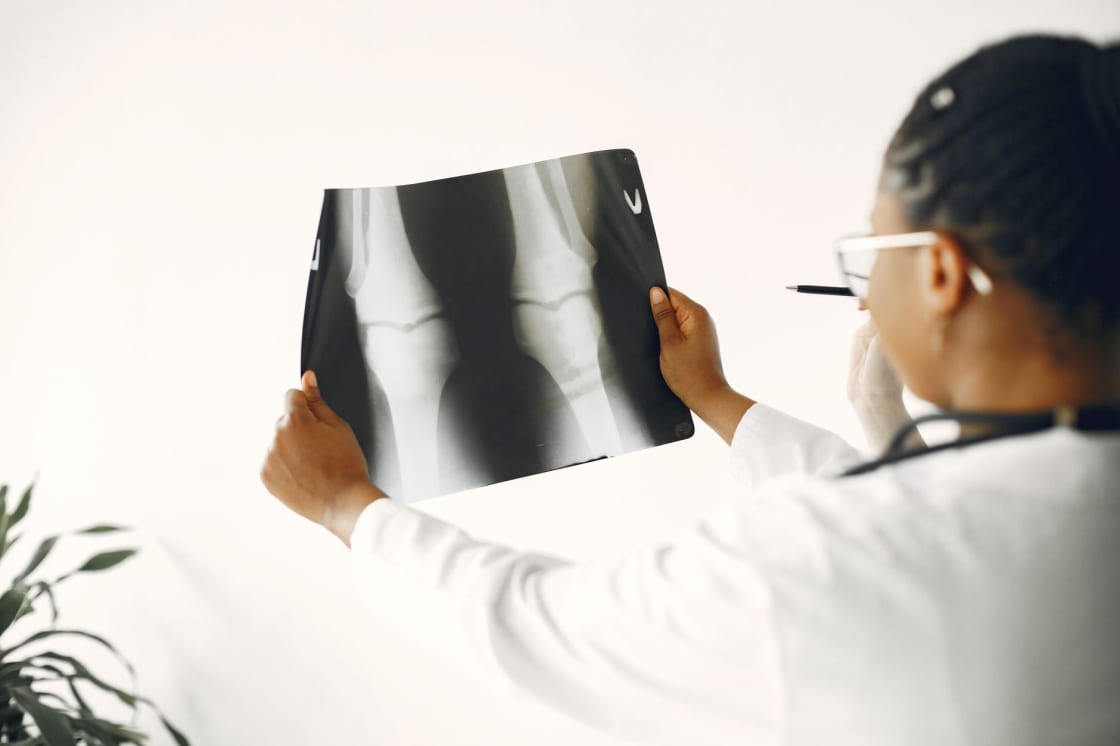 A clinician in a white coat holds a knee radiograph up to the light, examining the joint