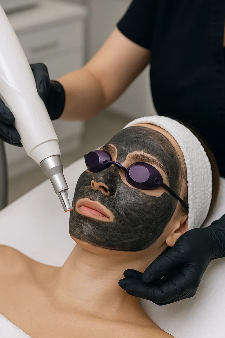 Carbon Laser Facial