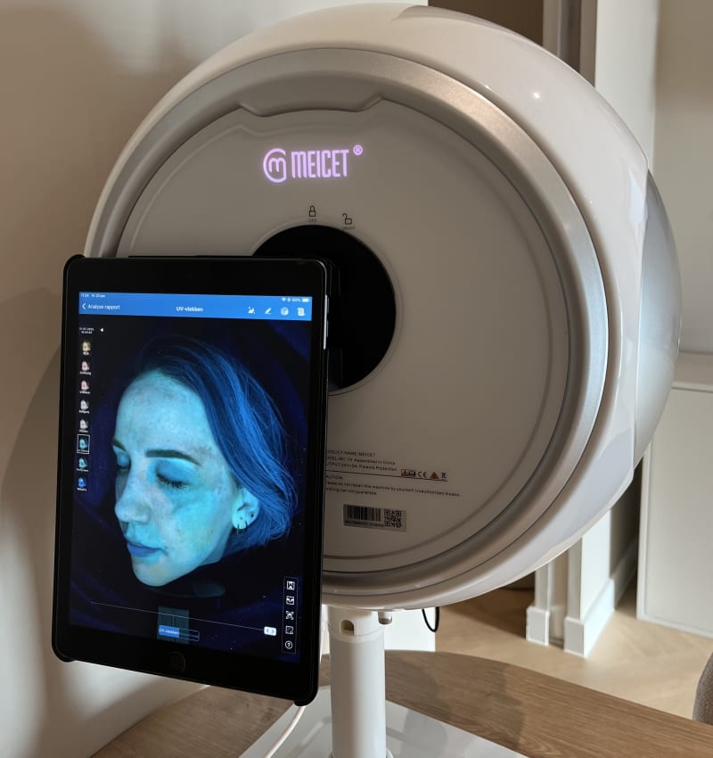 Huidscan