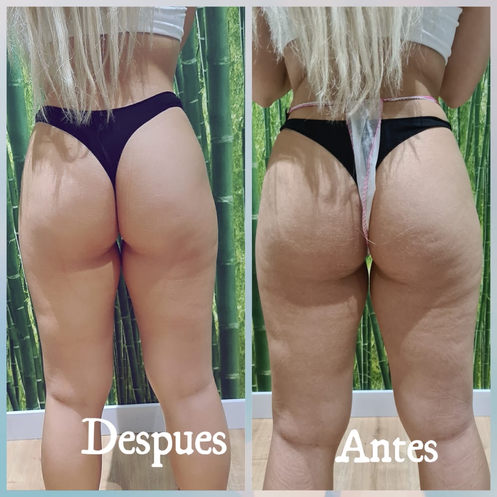 Estética avanzada unisex en Madrid.