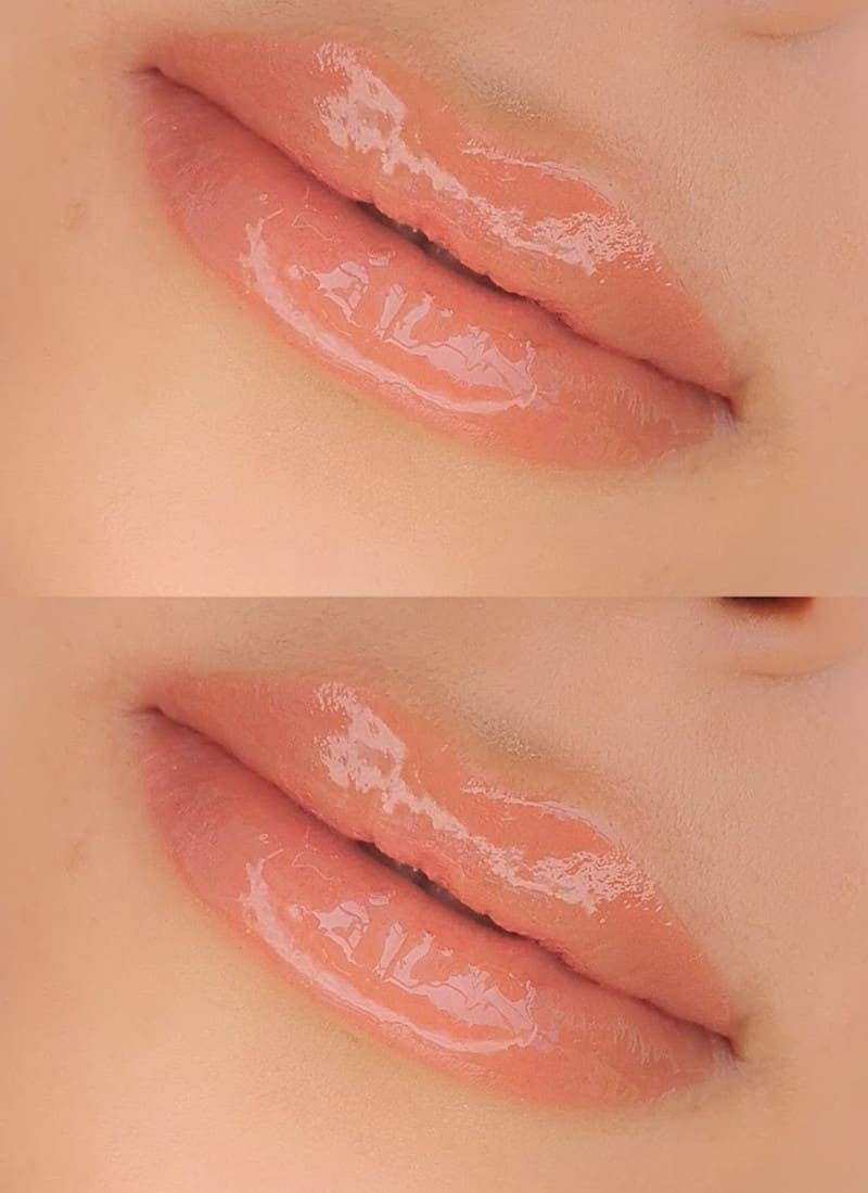 Lips