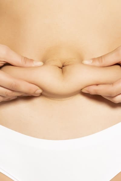 Lipocavitation 