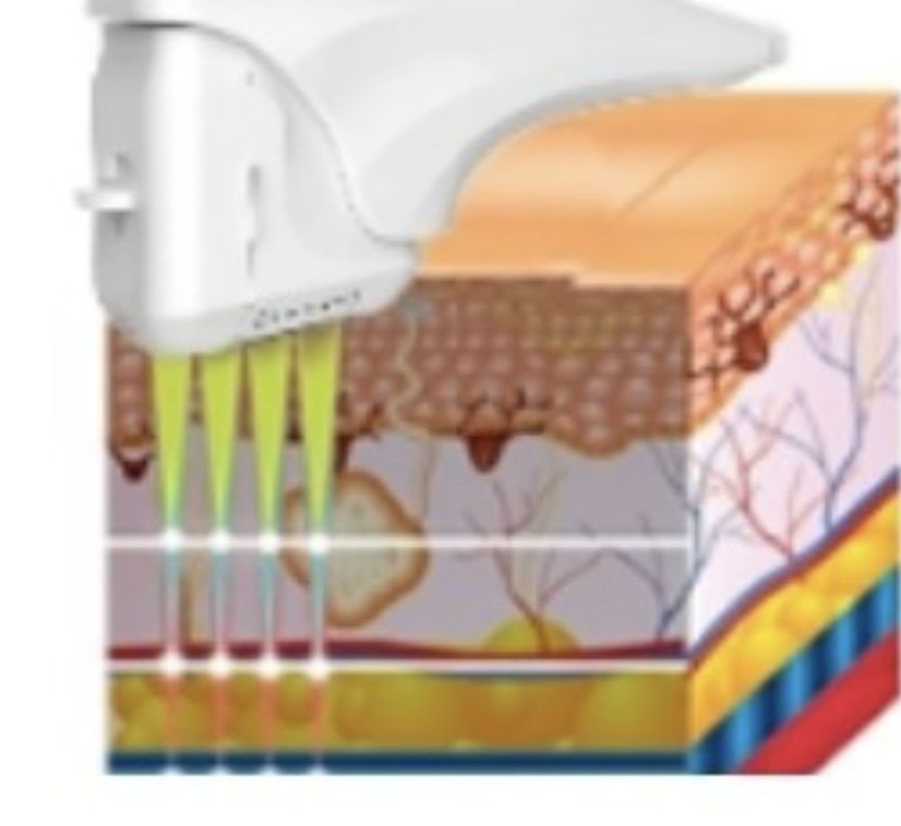 Beauty Band Club à  Asnières