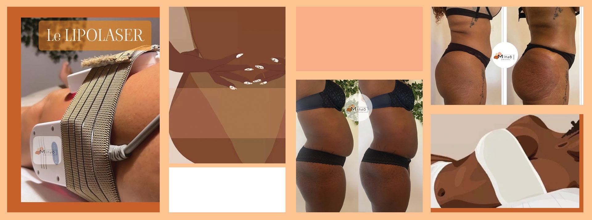 centre de soins minceur et de bien-être au Lamentin