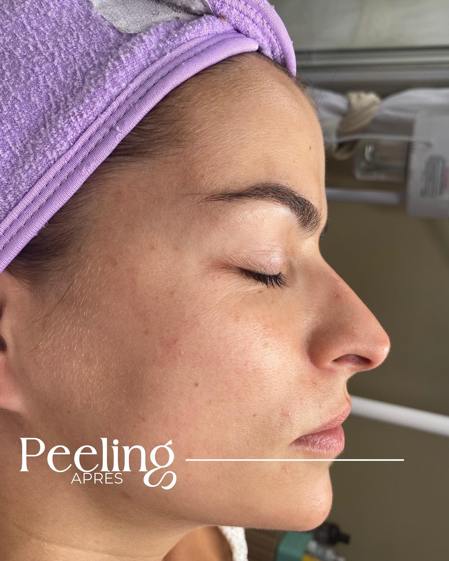 Spécialiste en soins visage à Paris