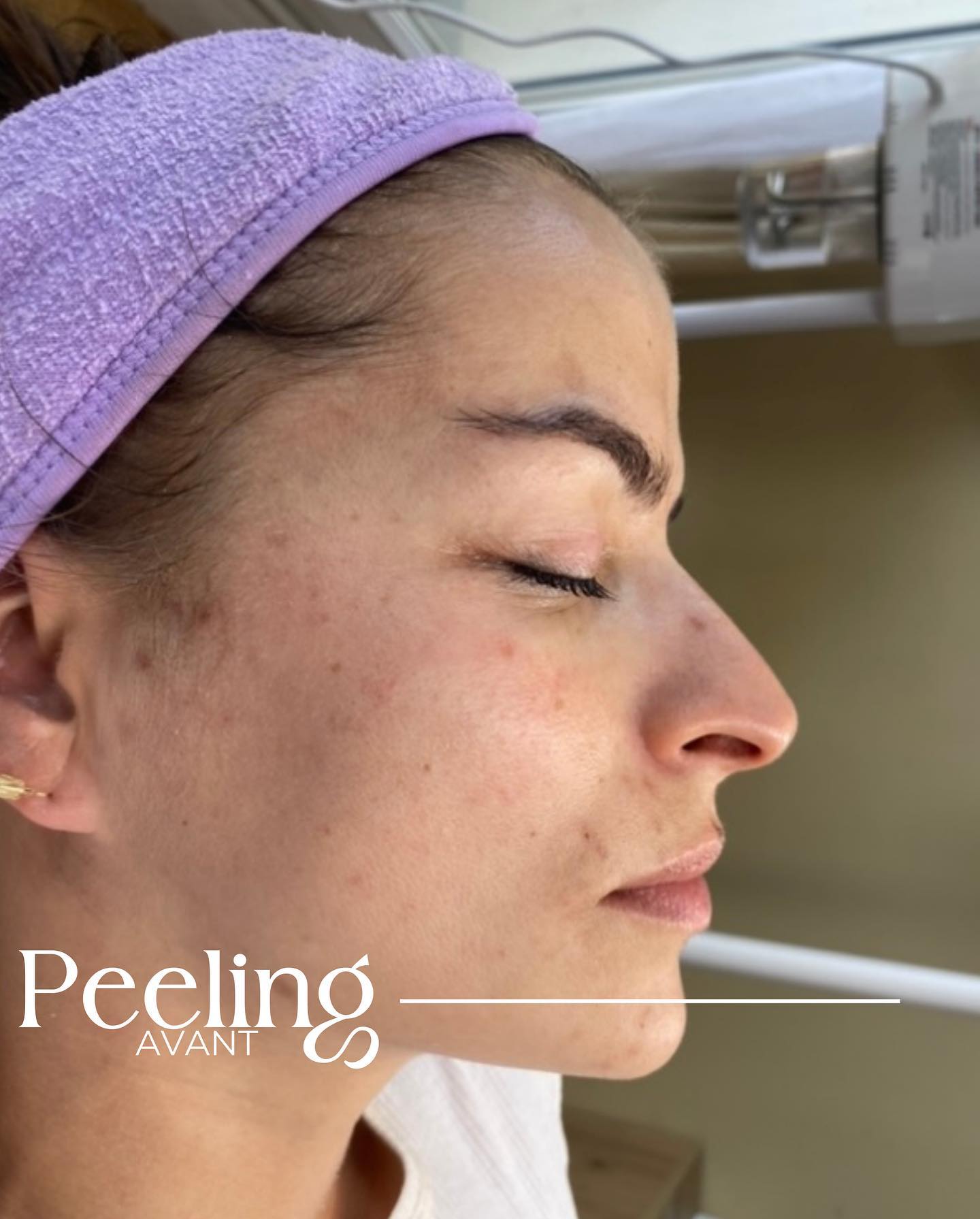Spécialiste en soins visage à Paris