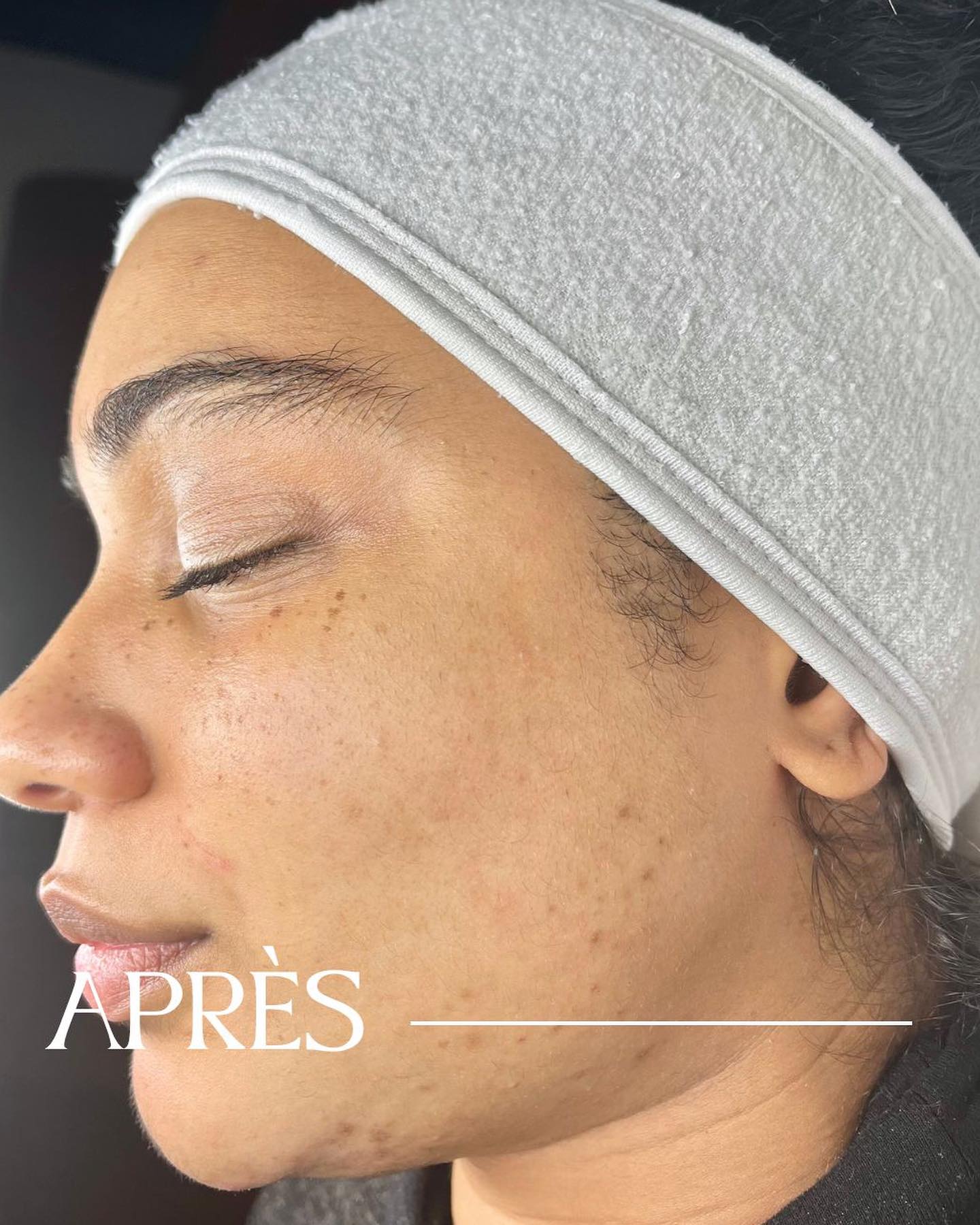 Spécialiste en soins visage à Paris