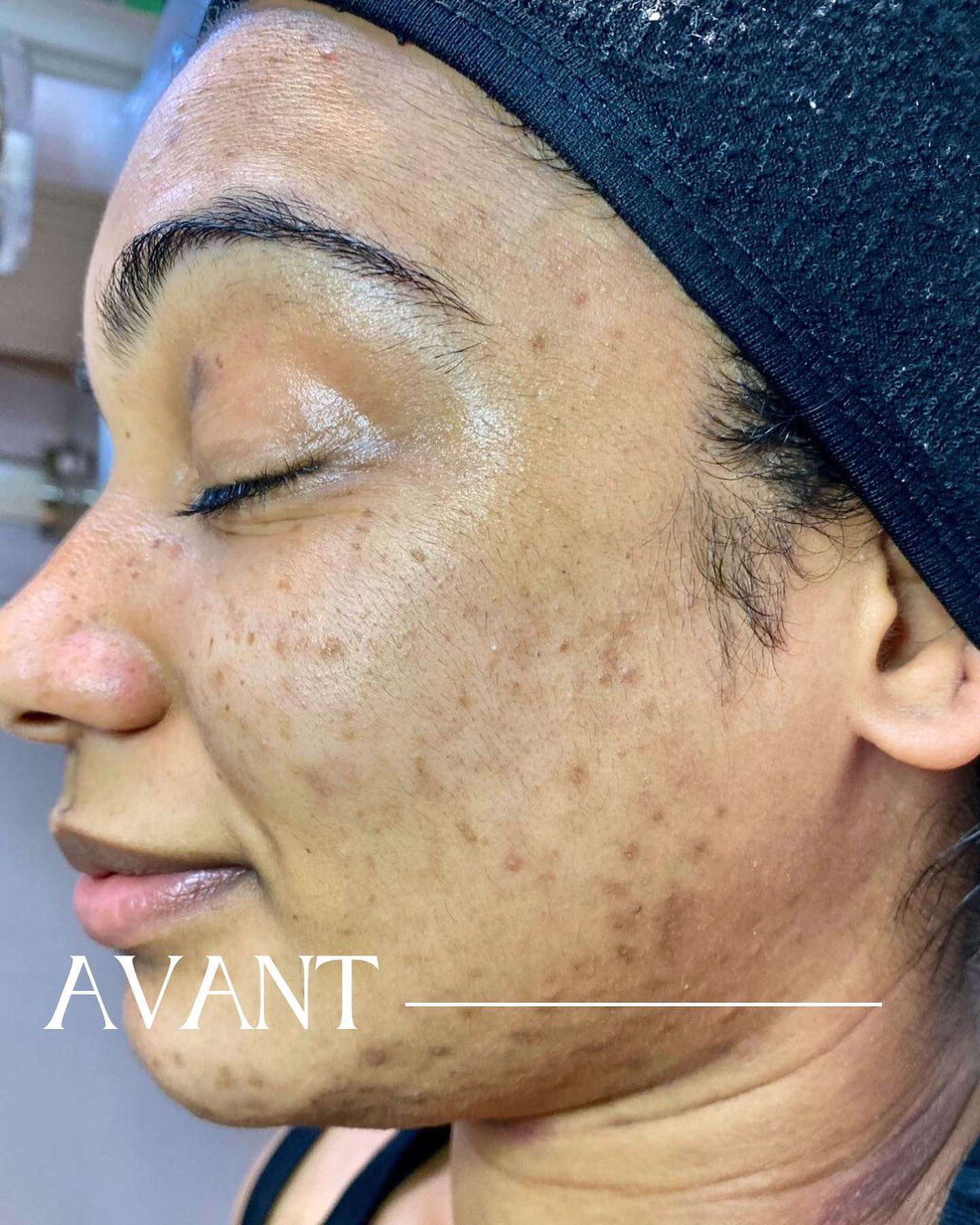 Spécialiste en soins visage à Paris