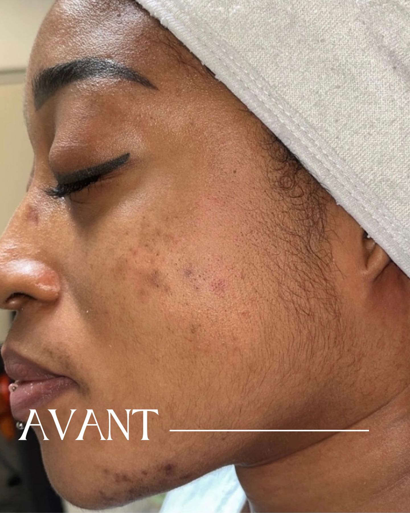 Spécialiste en soins visage à Paris