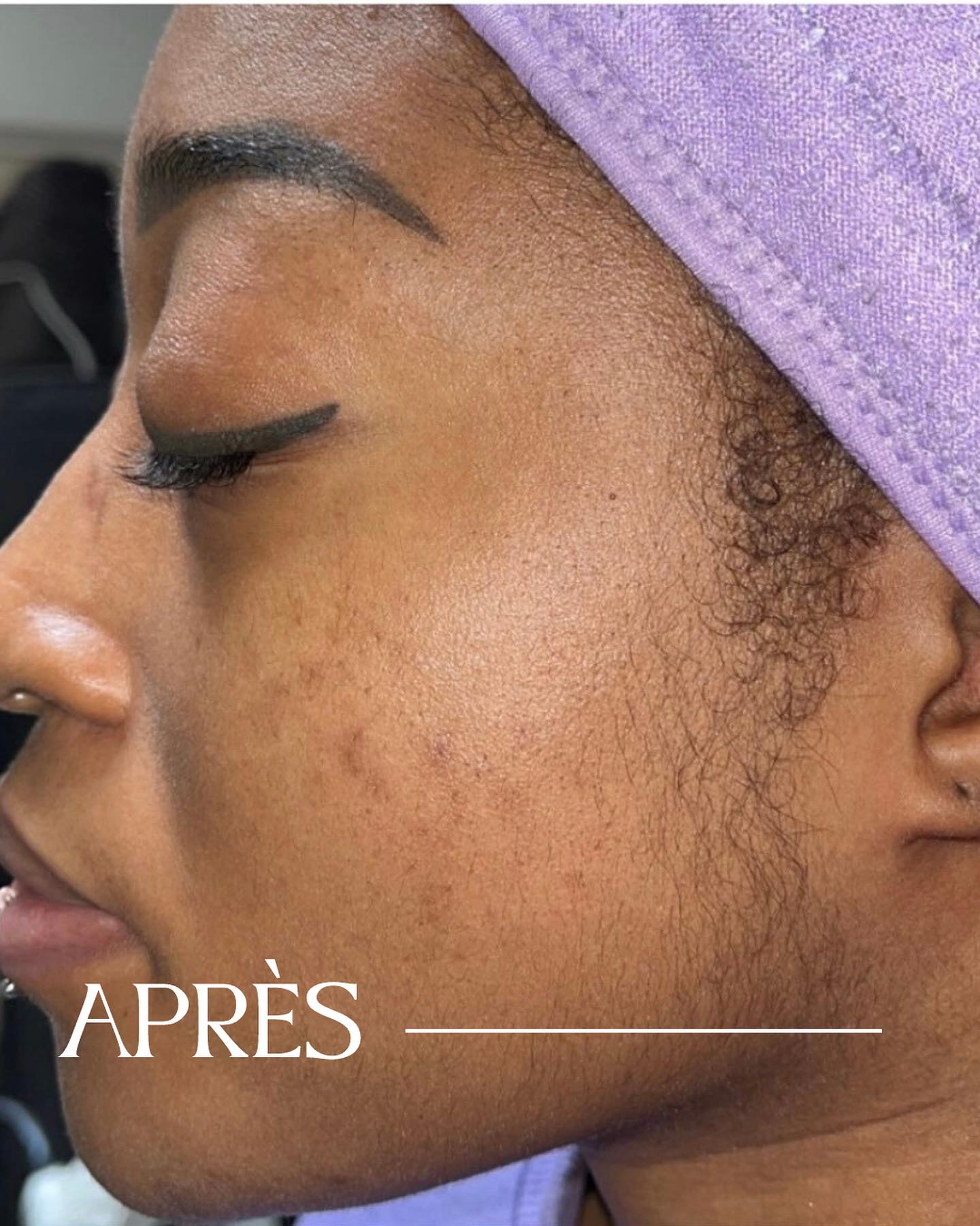 Spécialiste en soins visage à Paris