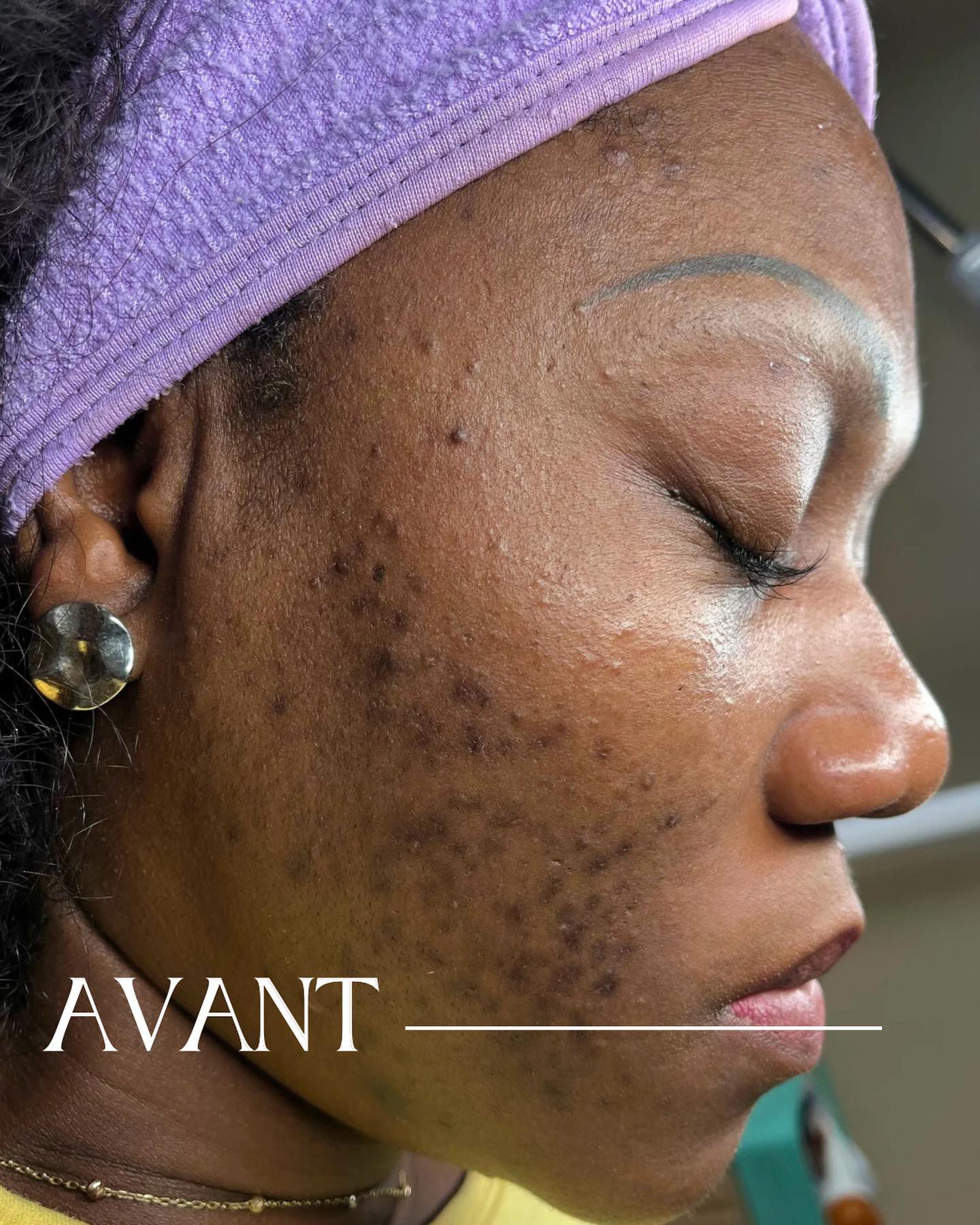 Spécialiste en soins visage à Paris