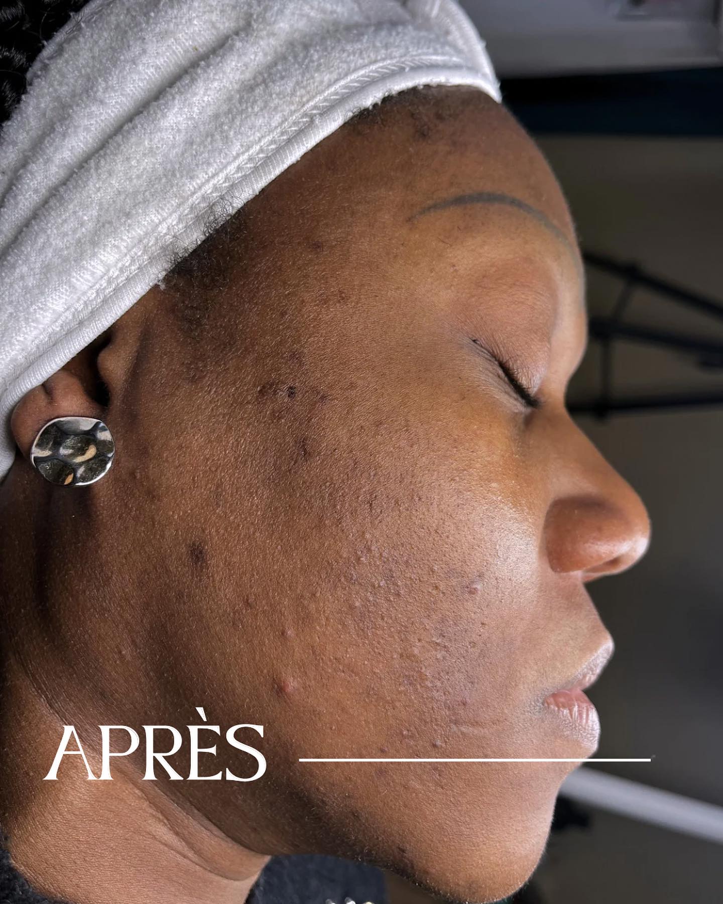 Spécialiste en soins visage à Paris