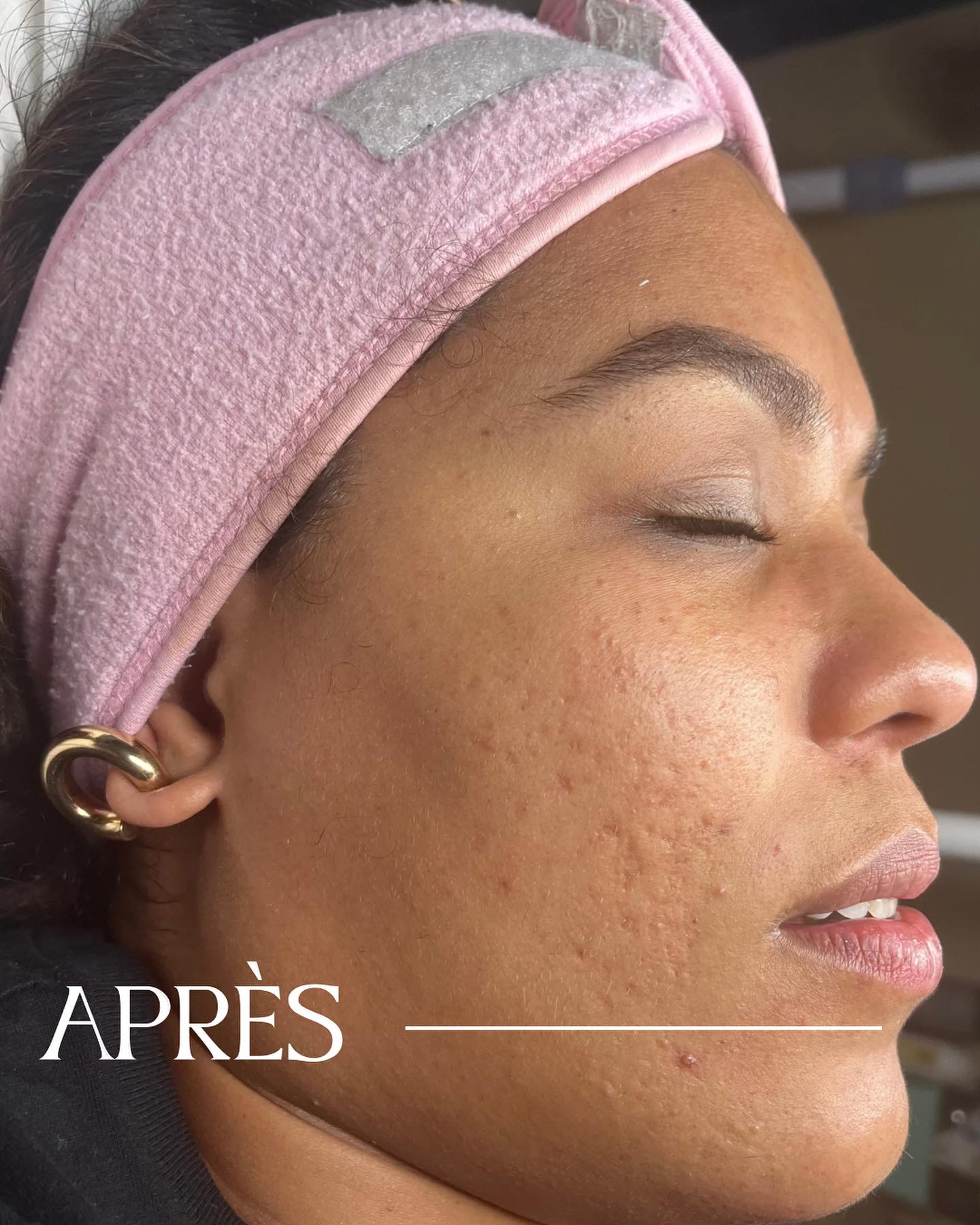 Spécialiste en soins visage à Paris