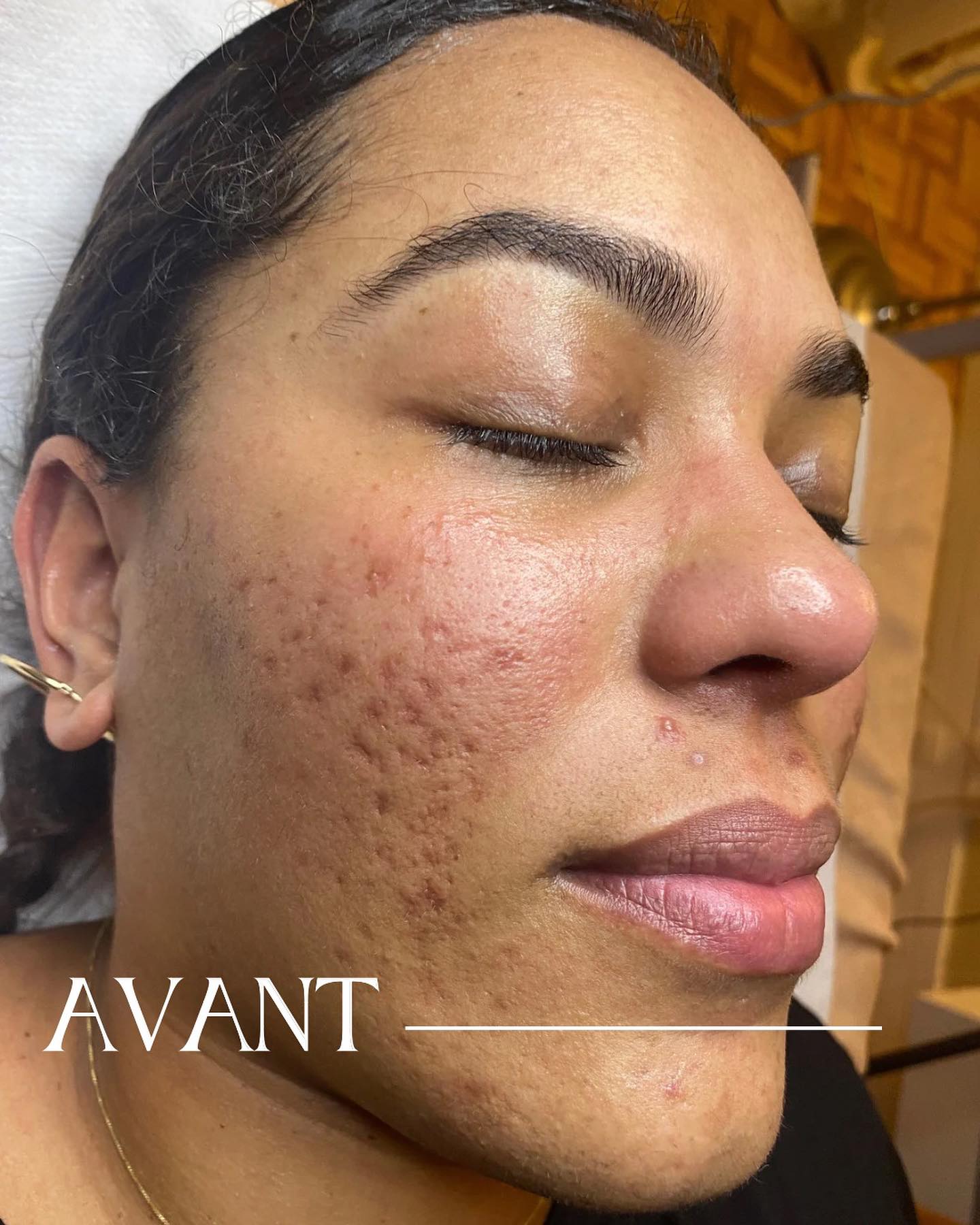 Spécialiste en soins visage à Paris