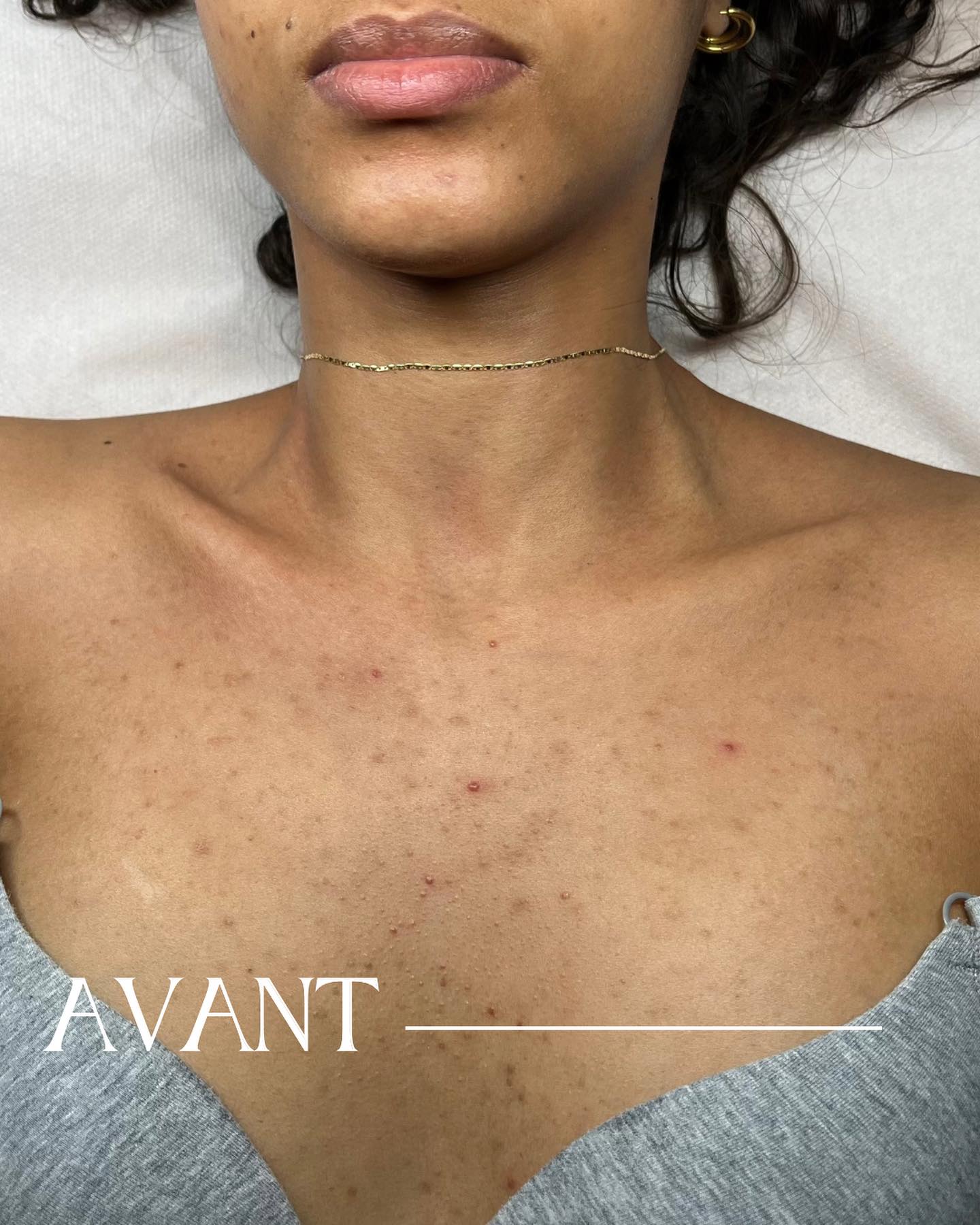 Spécialiste en soins visage à Paris