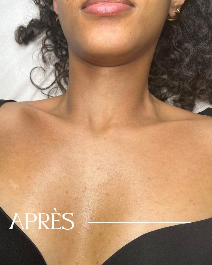 Spécialiste en soins visage à Paris