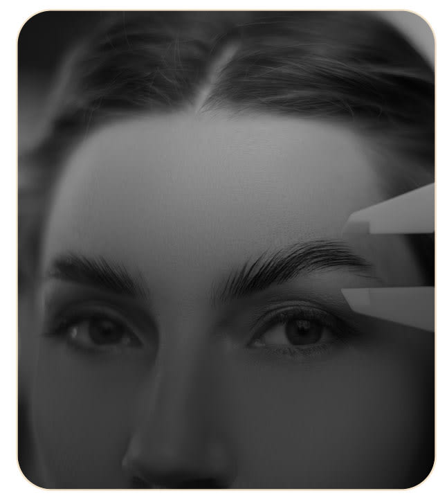 Browlift 
