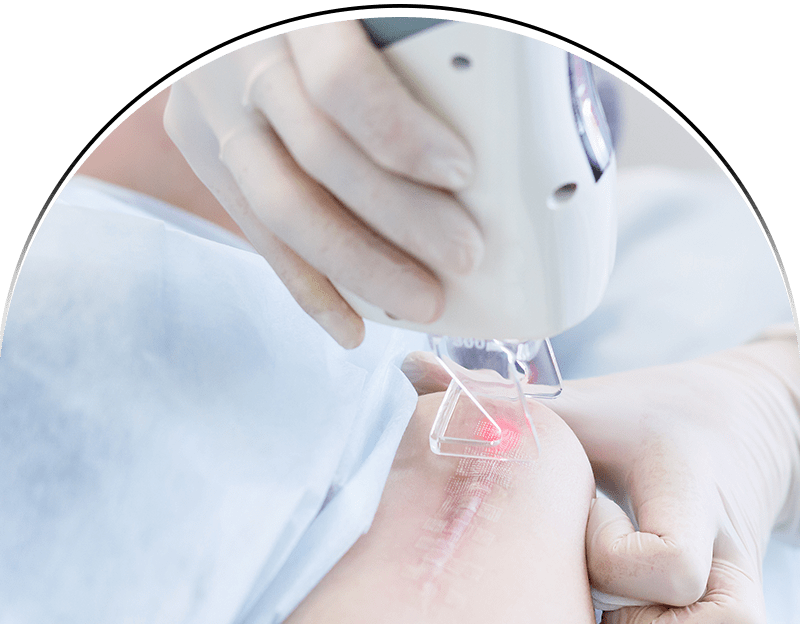 Soins pour les cicatrices