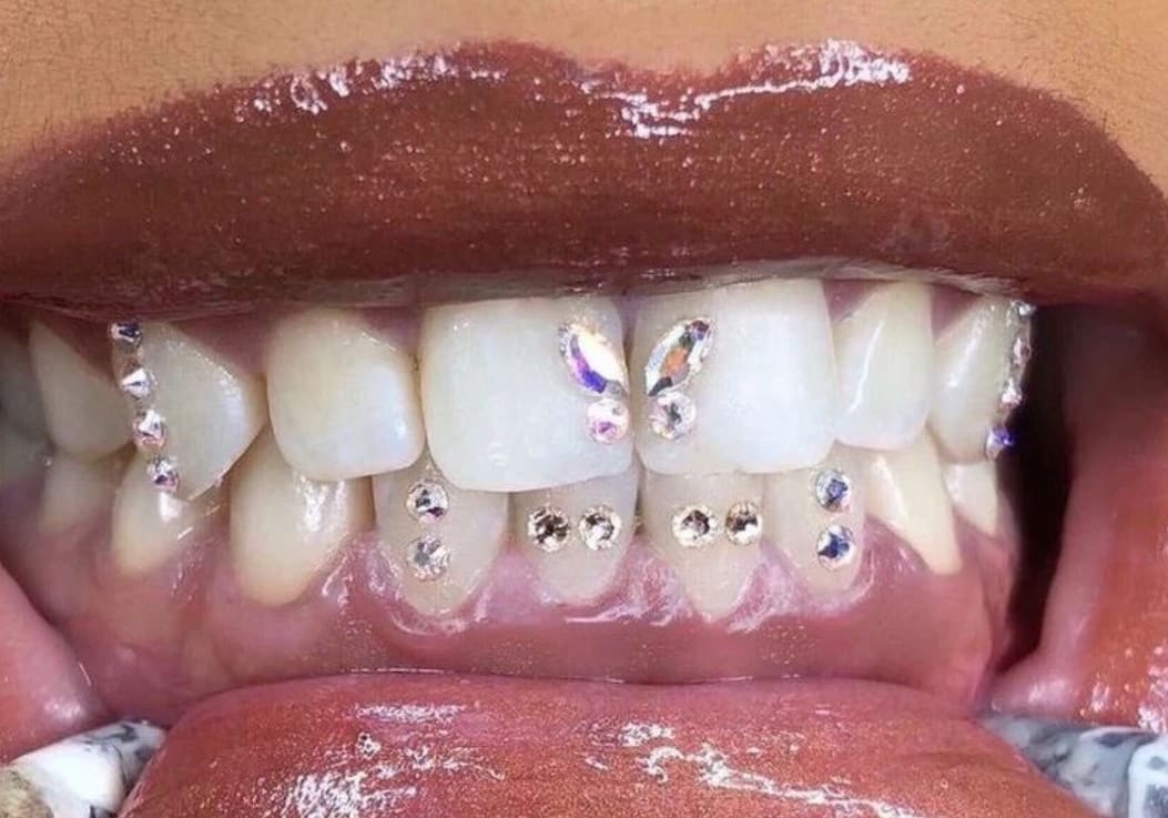 Embellissement dentaire & strass dentaire