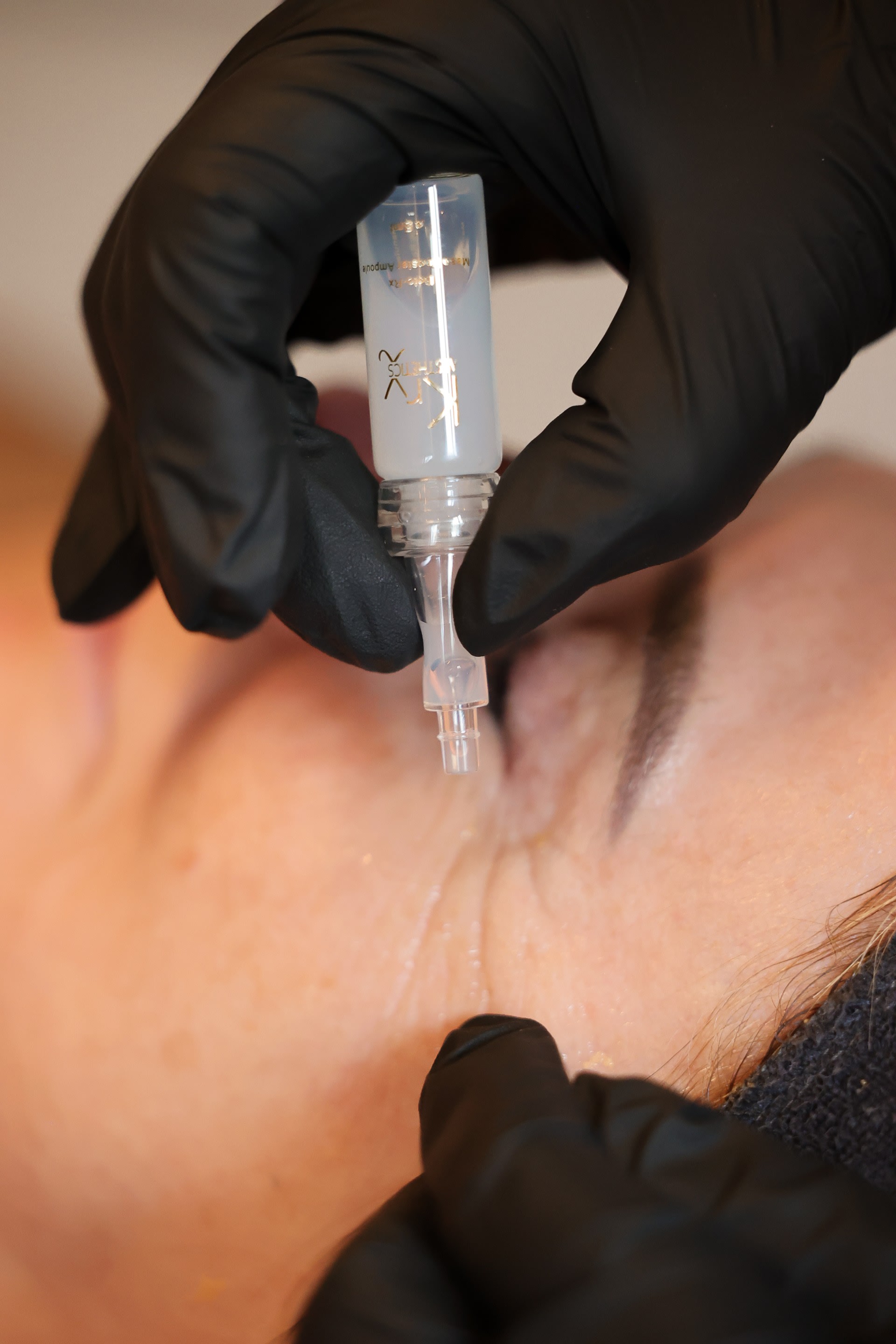 Microneedling met een steriel KRX-serum rond het oog