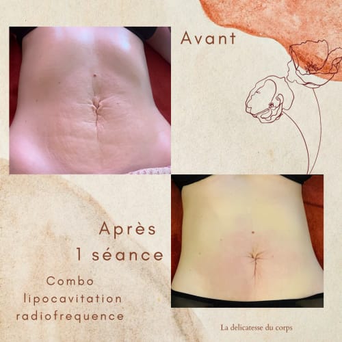 La Délicatesse du Corps à Roubaix