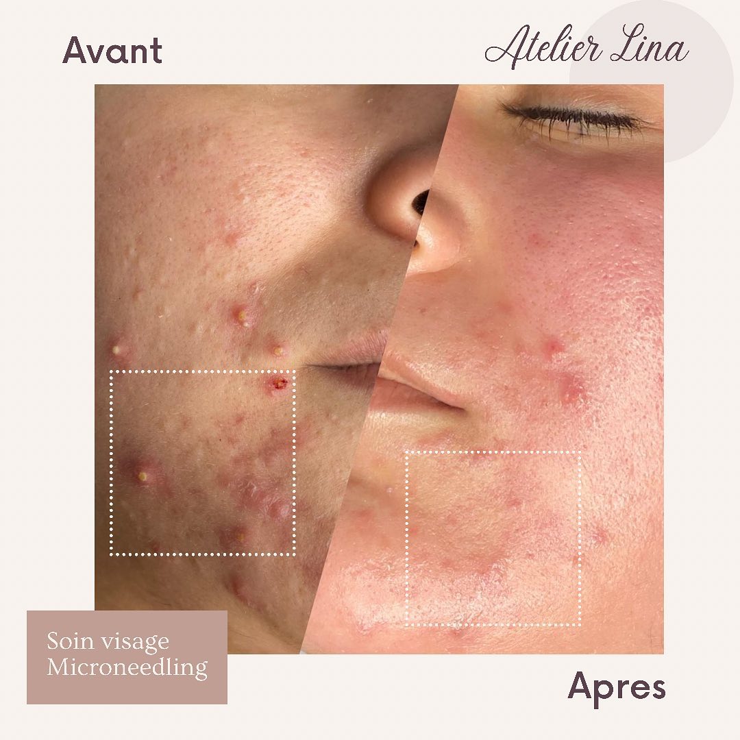 Technicienne beauté diplômée & déclarée à Maisons-Laffitte
