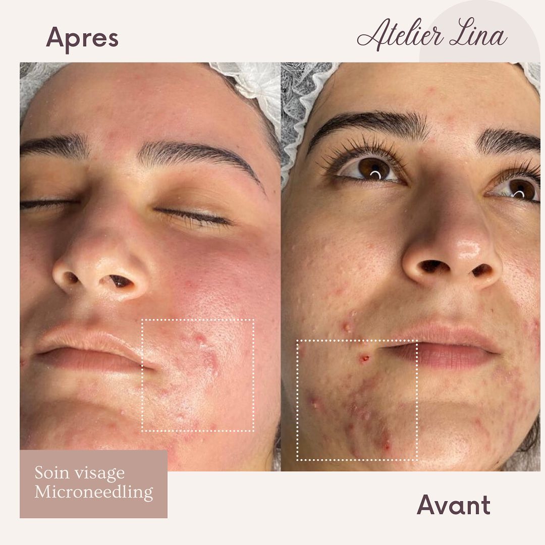 Technicienne beauté diplômée & déclarée à Maisons-Laffitte