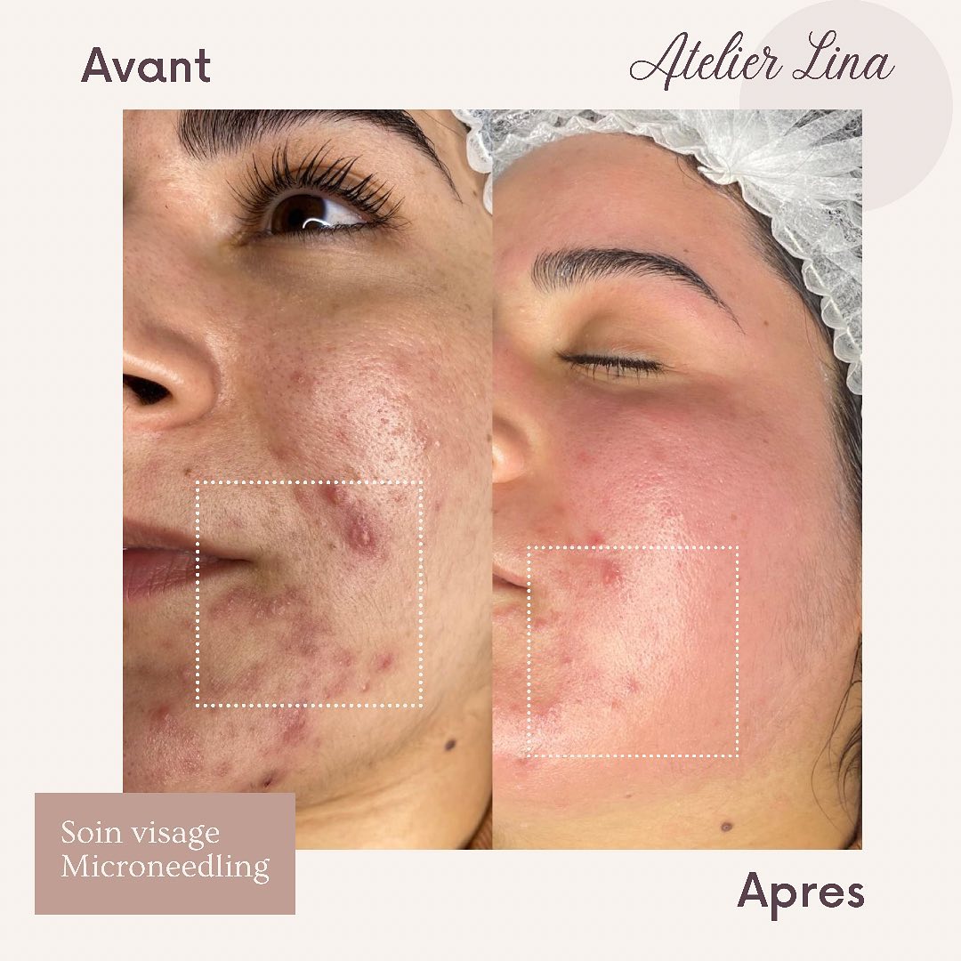 Technicienne beauté diplômée & déclarée à Maisons-Laffitte