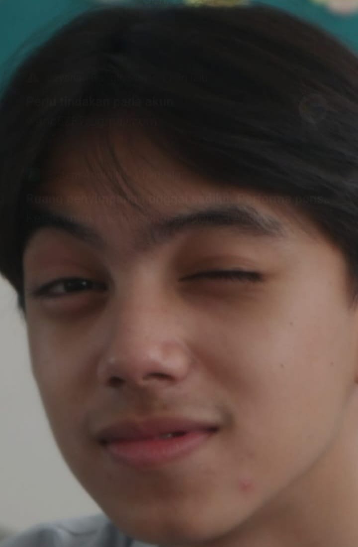 Foto Acle