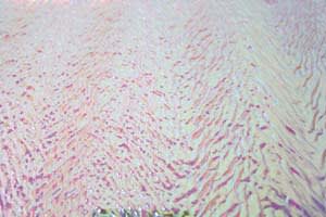 COE90 DIKROISK PÅ KLAR U50-00 UCR-TE HERRINGBONE R